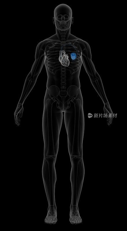 人体骨骼，心脏和胸部起搏器
