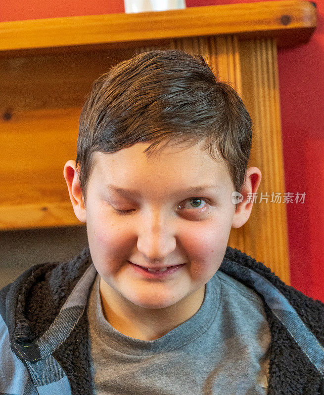 14岁视障男孩肖像
