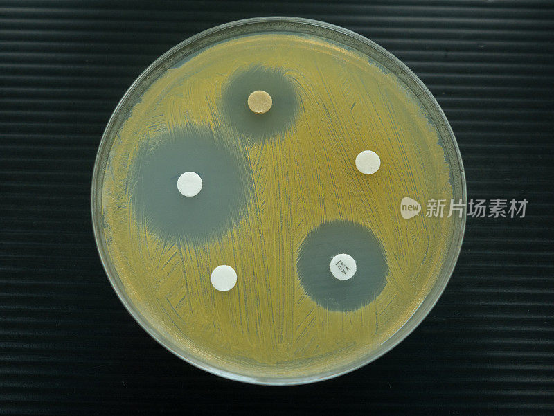 在实验室检查抗生素的培养皿的特写镜头。