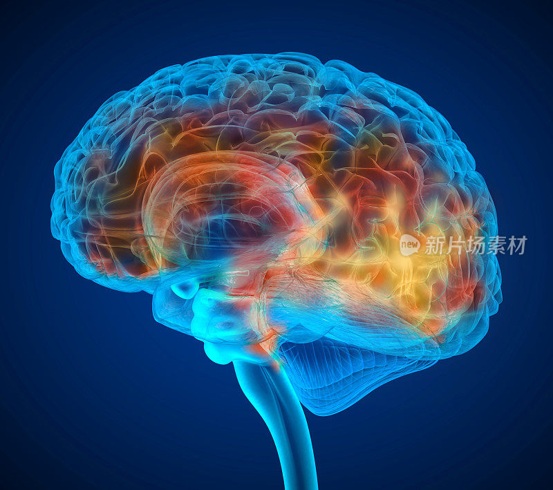 人脑肿瘤x射线扫描，医学上精确的3D插图