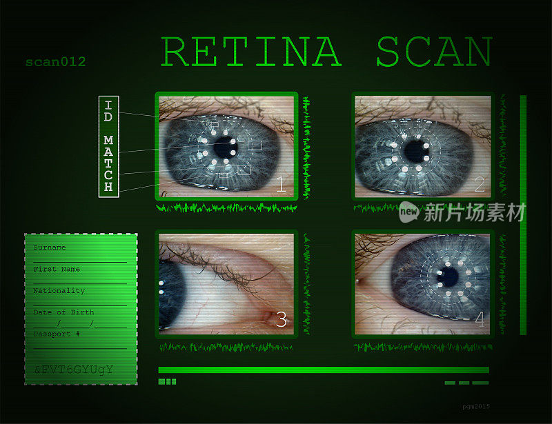 视网膜扫描-蓝眼睛