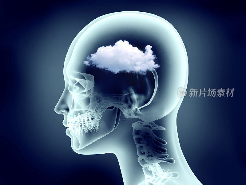 有云的人类头部的x光图像