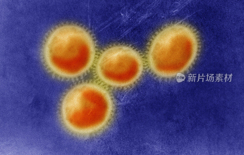 冠状病毒显微图像