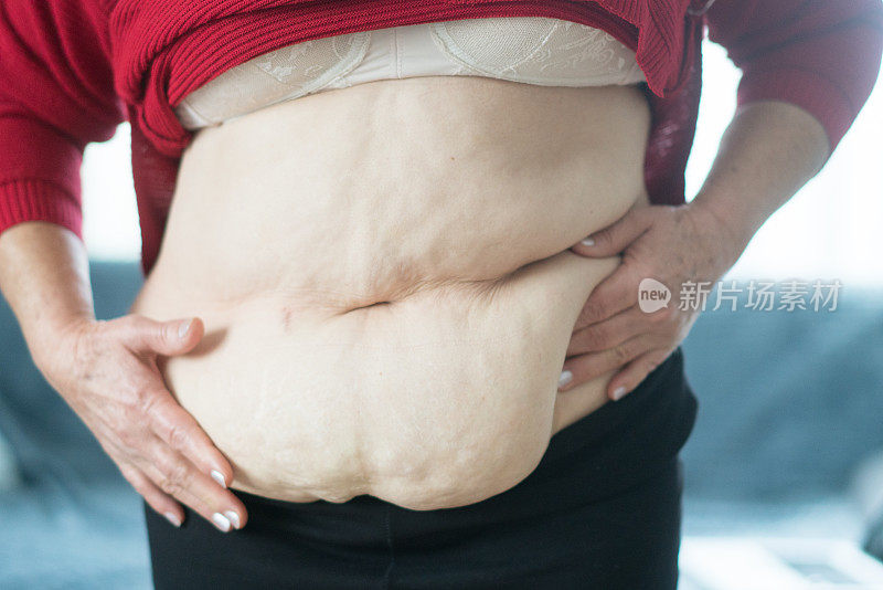 超重的成熟女人用手捏着肚子上过多的脂肪。