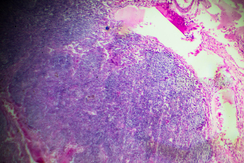 显微镜下嗜酸性粒细胞血细胞