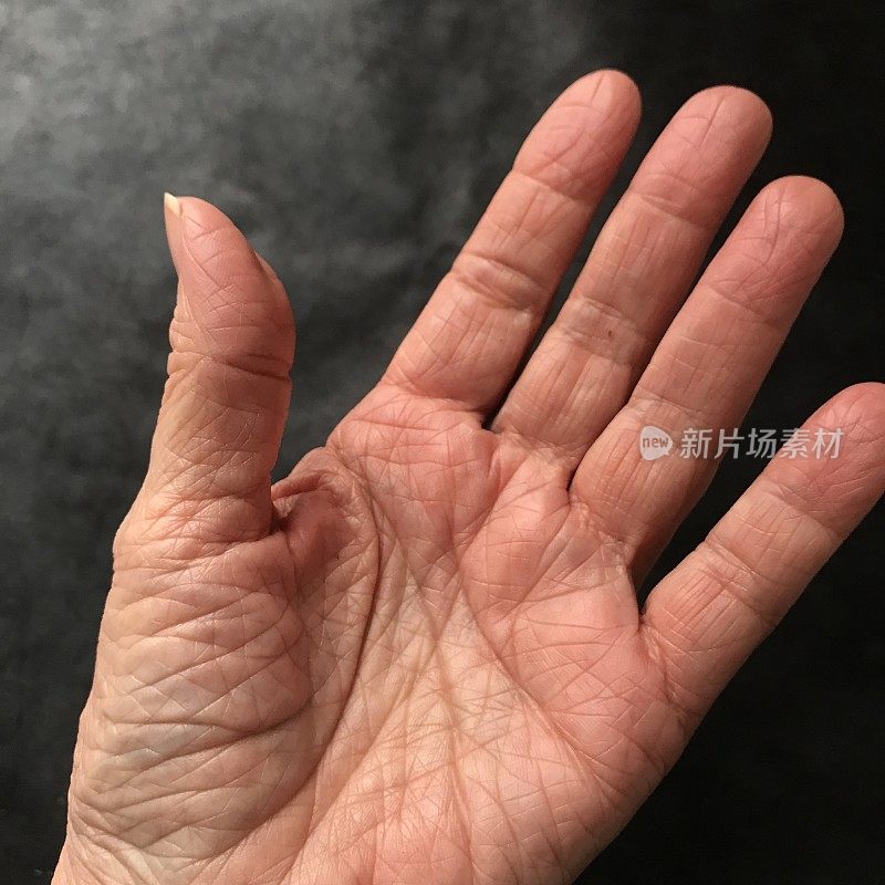 衰老的手有皱纹和拇指关节炎