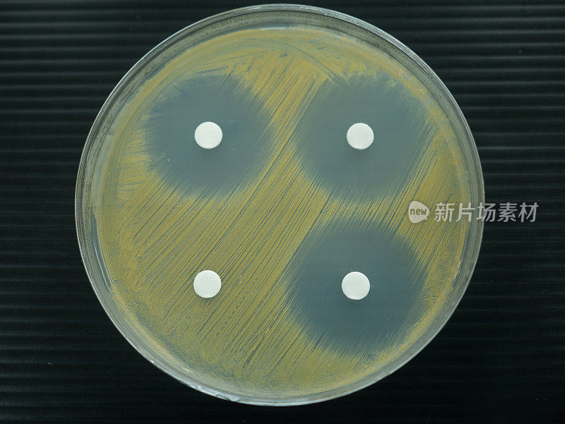 在实验室检查抗生素的培养皿的特写镜头。