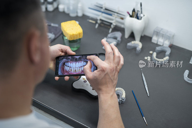 牙科技师使用电话使假牙准确。