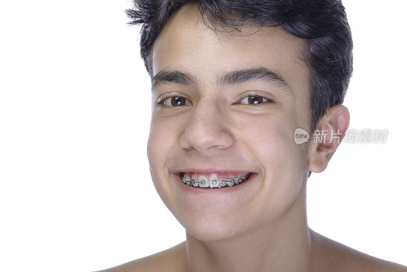 十几岁的男孩戴着白色背景的牙套