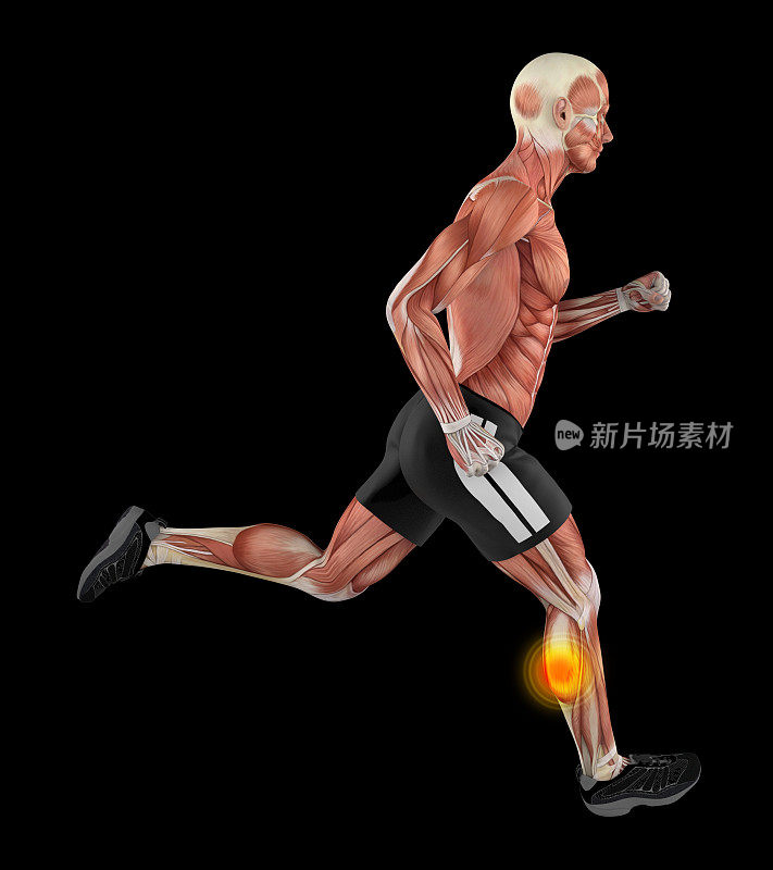 一个男子跑步的3D插图，突出小腿受伤