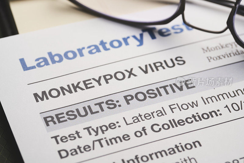 猴痘病毒测试结果文件