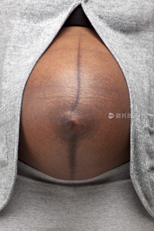 怀孕腹部色素沉着增加。