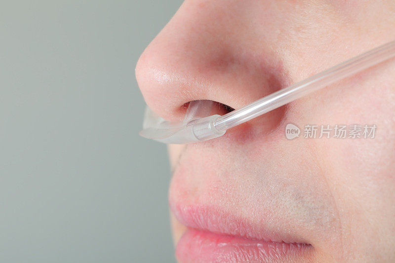 氧气管插在病人的鼻子里