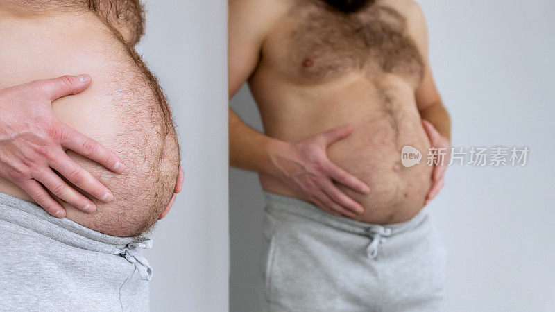 裸胖大肚子的男人摇着肚子上的脂肪褶皱，肥胖，健康，啤酒肚。身体的问题部位。荷尔蒙。超重。肥胖。本空间