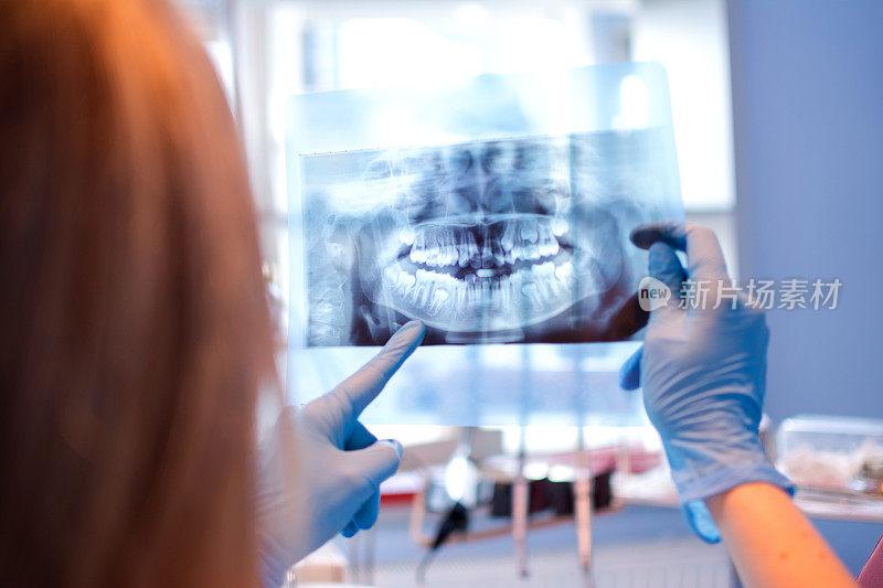 近距离女牙医指着病人的x光图像在牙科诊所。