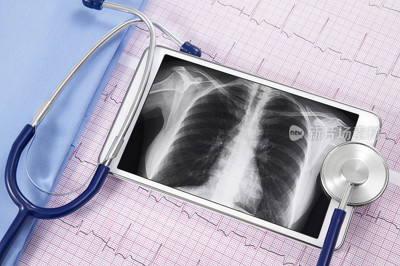 肺x光片和听诊器及心电图