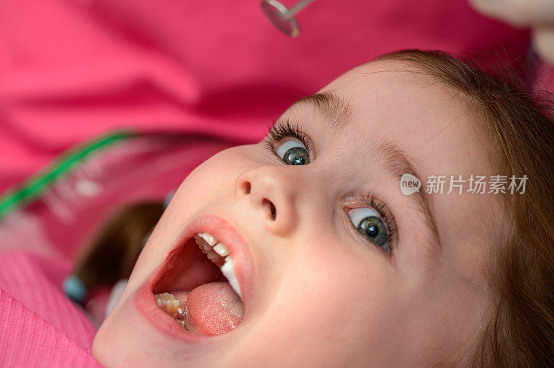 在孩子治疗乳牙时，要去看牙医。