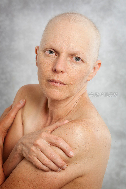 裸肩乳腺癌患者的肖像。