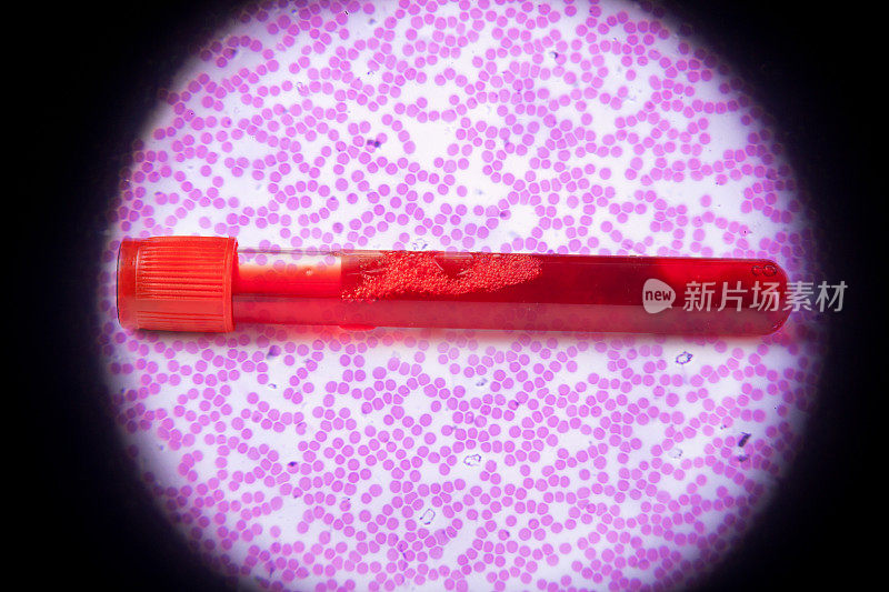 显微镜下的人类血液涂片