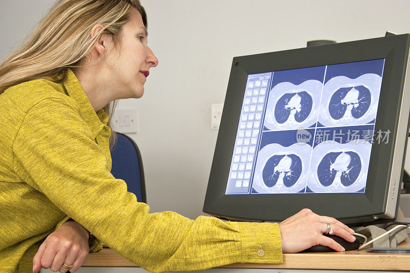 放射科医生报告电脑上的数字CT胸部扫描
