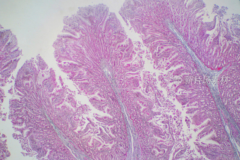 显微镜下观察人体大肠组织。人类生理学的组织学。