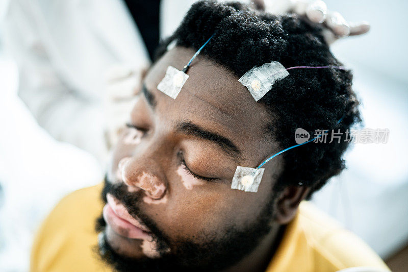 医生将电极放在病人头上进行多导睡眠检查(睡眠研究)