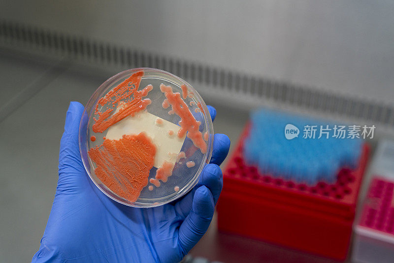 生产培养物的实验室技术员在医院微生物科工作。