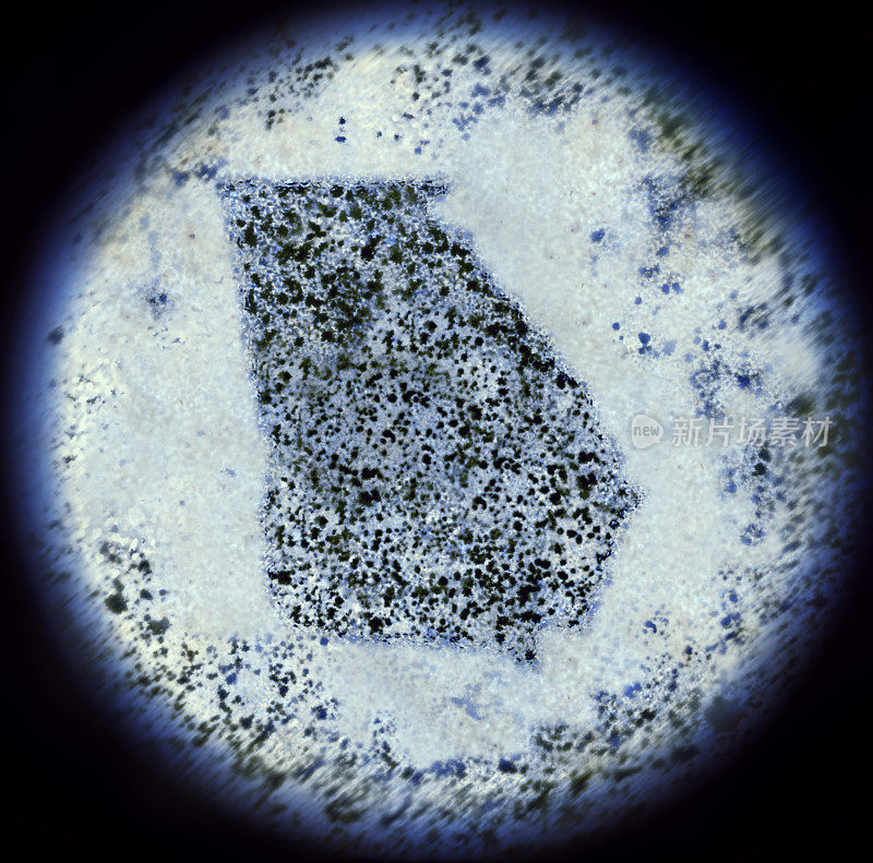 通过显微镜观察成乔治亚形的细菌。(系列)