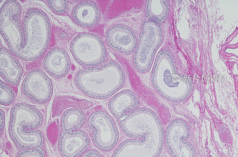 精子，附睾，输出管的显微图。