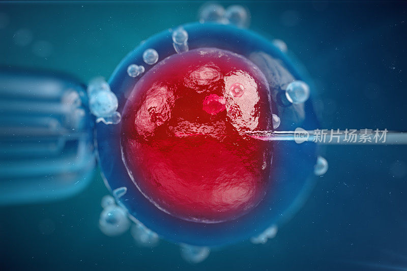 体外受精，将精子注入卵细胞，辅助生殖治疗。