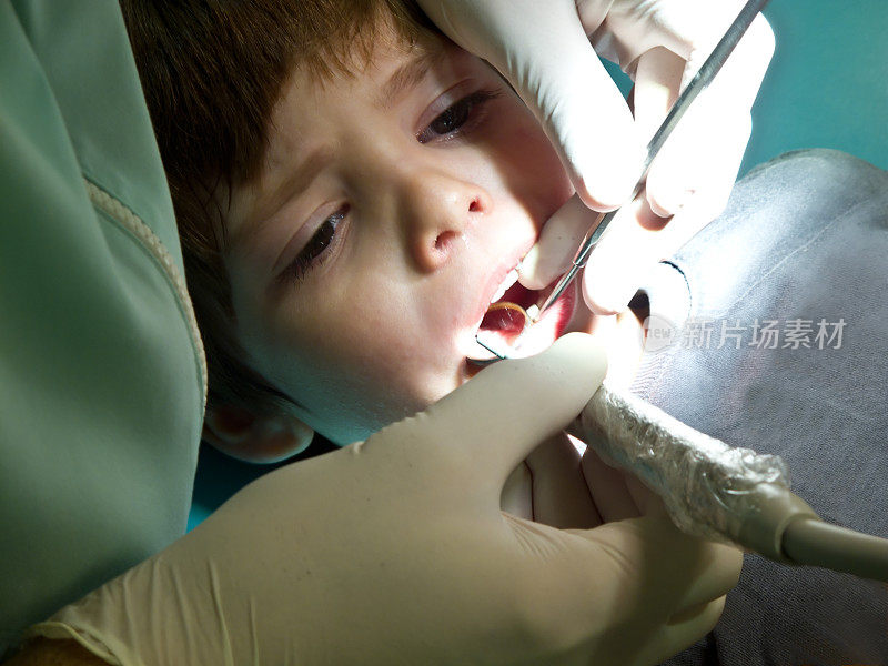 牙科诊所-检查