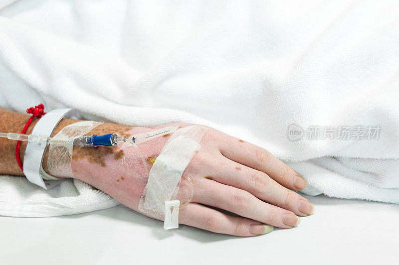 选择性聚焦手部和生理盐水滴注-患者入院时需要静脉滴注生理盐水