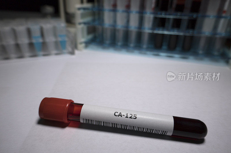 卵巢癌肿瘤标志物CA-125