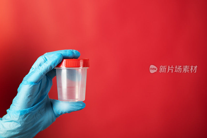 尿液分析，罐子用于肾脏疾病诊断测试，全身体检，保健，在医生手中戴着红色背景的医用手套