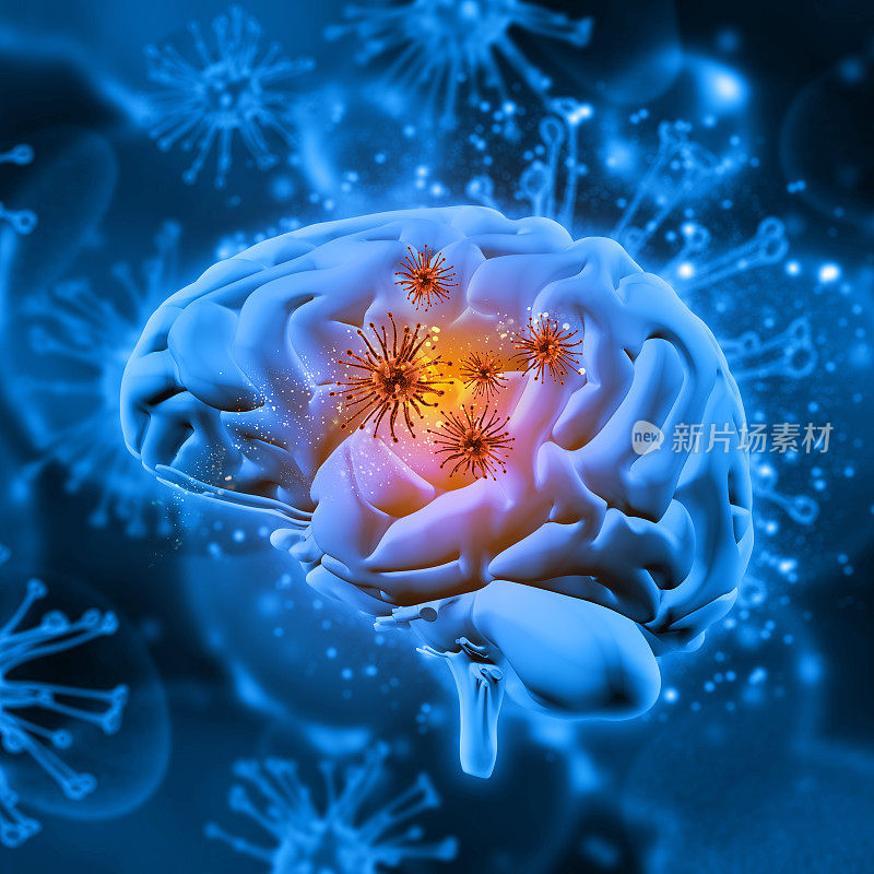 3D医学背景与病毒细胞攻击大脑