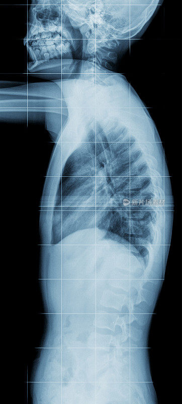腰骶椎和头部x光片。医院的概念