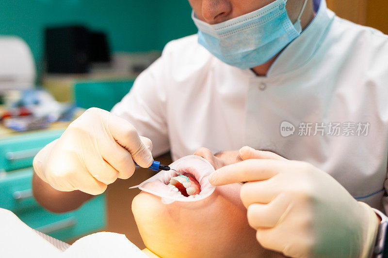 在牙齿增白过程中，病人带着面颊牵拉器躺在牙科椅上