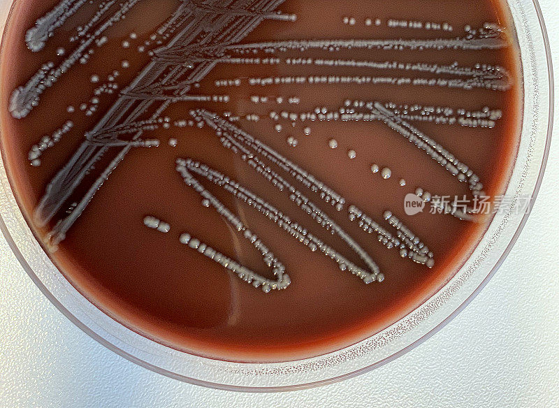 产气荚膜梭菌是一种常见的食物中毒的毒素生产原因。