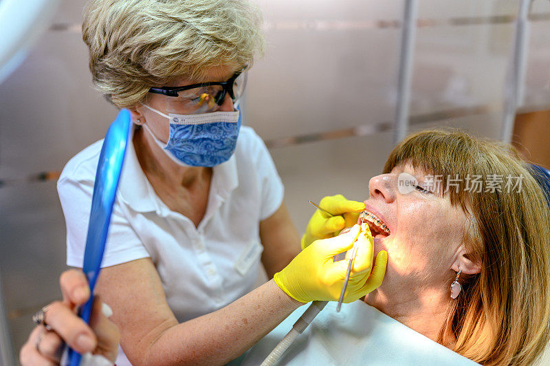 成熟的女人在牙医那里检查牙套