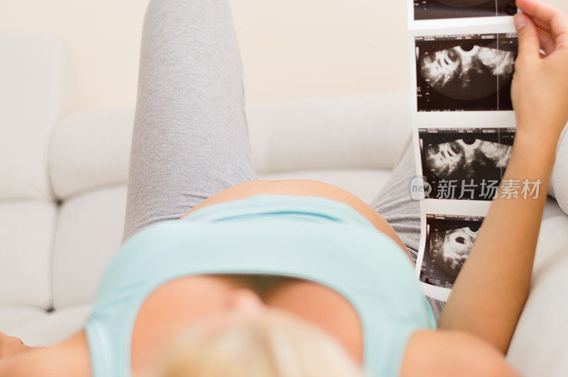 孕妇在看超声波扫描