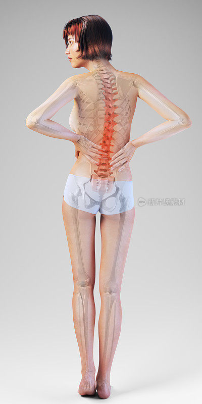 女性Backpain