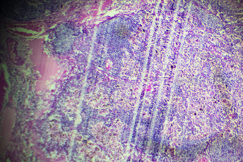 显微镜下嗜酸性粒细胞血细胞