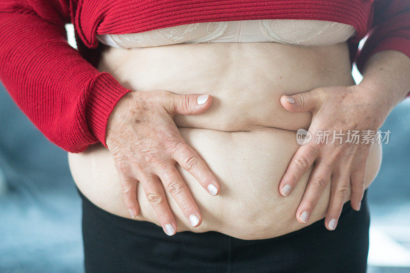 超重的成熟女人用手捏着肚子上过多的脂肪。