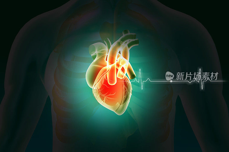 的心。心动图。心脏病发作或心脏病。三维演示