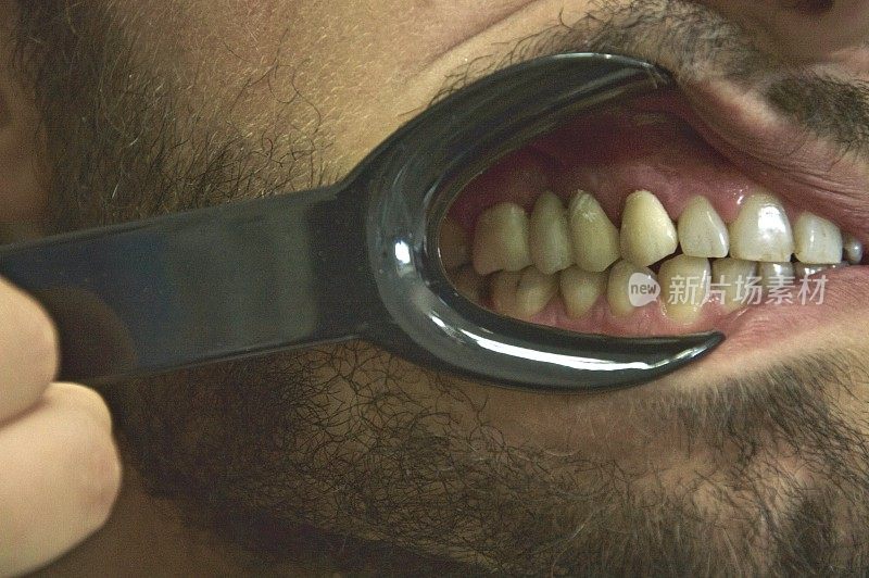 病人在牙医椅上检查口腔
