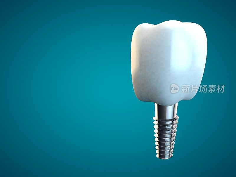牙磨牙种植牙卫生牙医3D蓝色