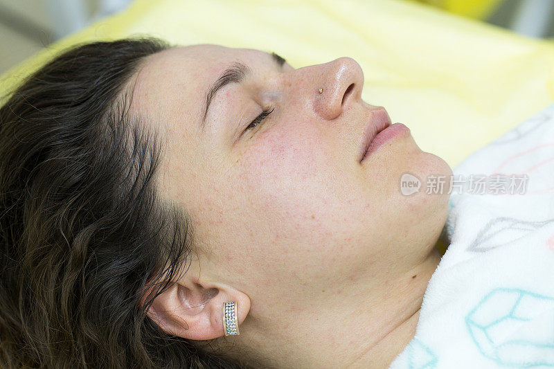一名妇女在做了美容手术后，脸上的皮肤变亮了。