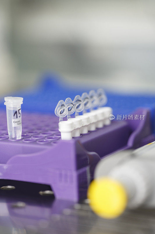 冠状病毒COVID-19病毒。实验室里的医学研究在实验室使用现代设备处理医学样本的科学家。医疗实验室设备用于分析的医疗设备。