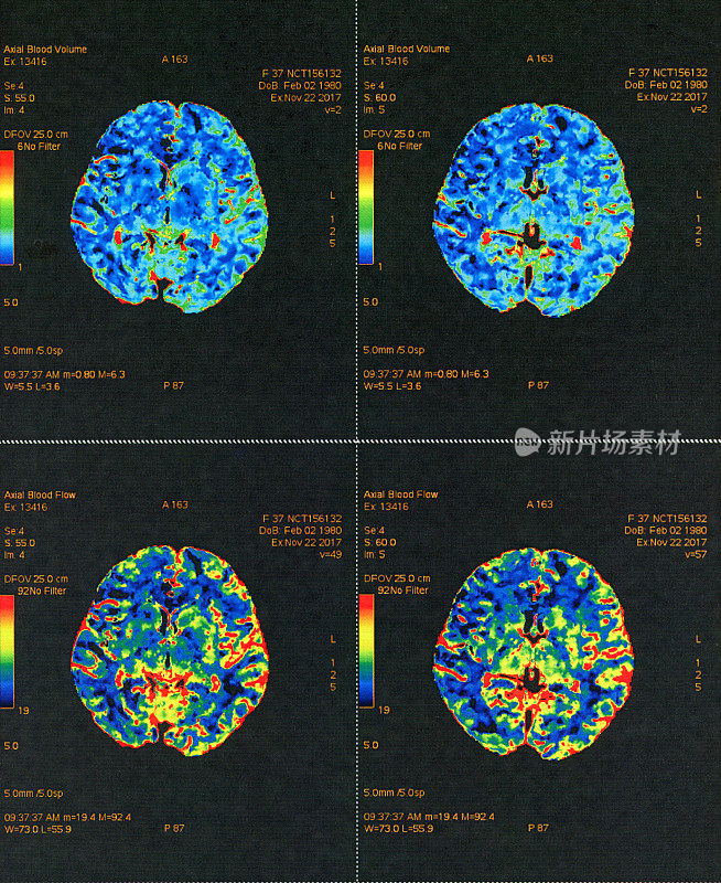 彩色MRI扫描人类大脑