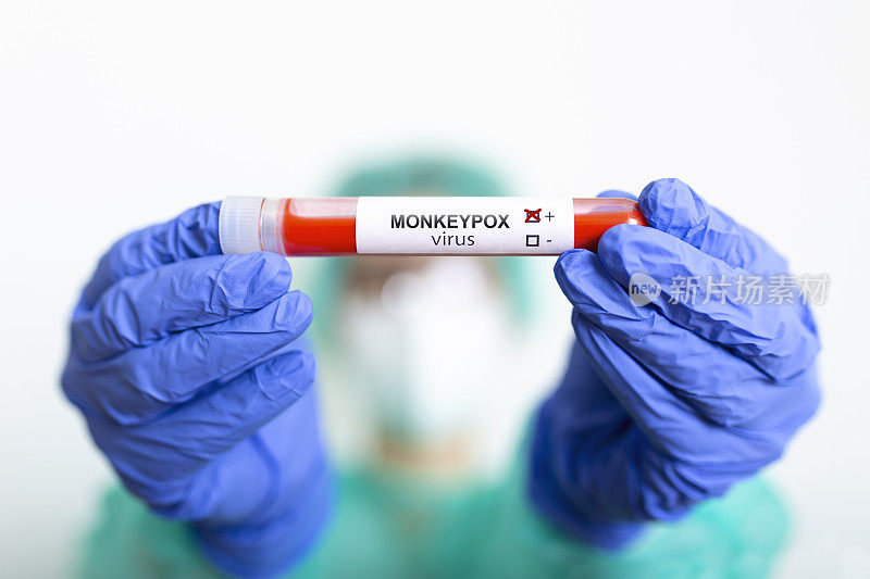猴痘病毒测试。它也被称为钱痘病毒，是一种双链DNA，人畜共患病病毒，是痘病毒科正痘病毒属的一种